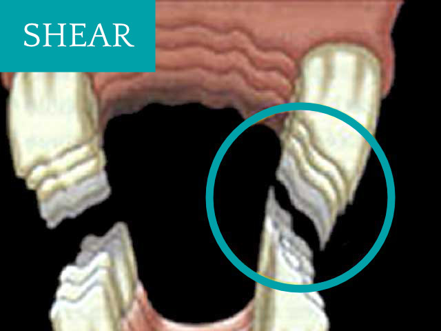 Shear Mouth Equine Dental | GEM Equine Ltd
