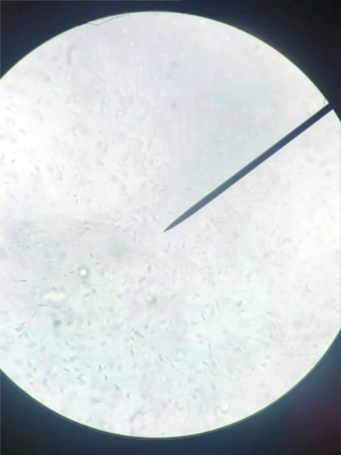 Equine Reproduction Artificial Insemination